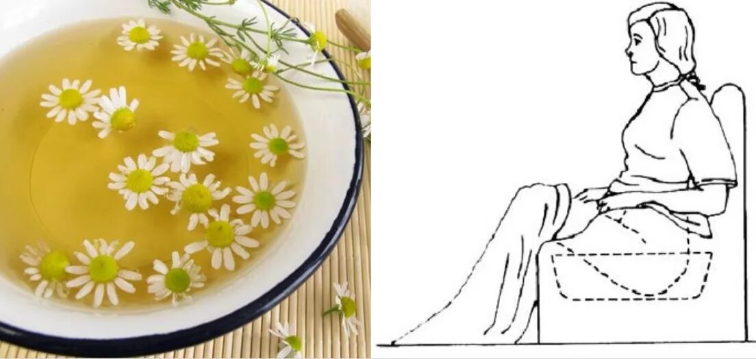 Ромашка при месячных