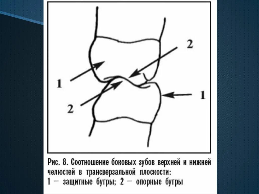 Соотношение зубных рядов в центральной окклюзии. Основы окклюзионной диагностики. Окклюзионная поверхность. Сагиттальная кривая шпее. Сагиттальная окклюзионная кривая (кривая шпее).