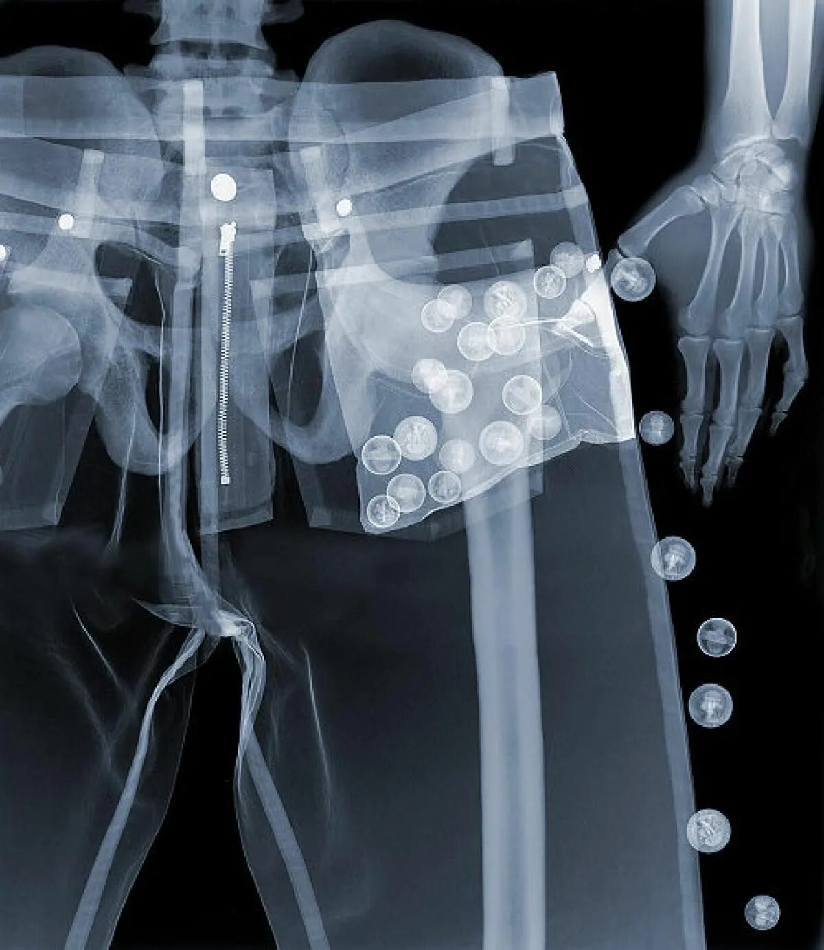 Фото рентгена. XRAY рентген. Рентгеновские снимки вещей. Вещи под рентгеном. Фотографирование в рентгеновских лучах.