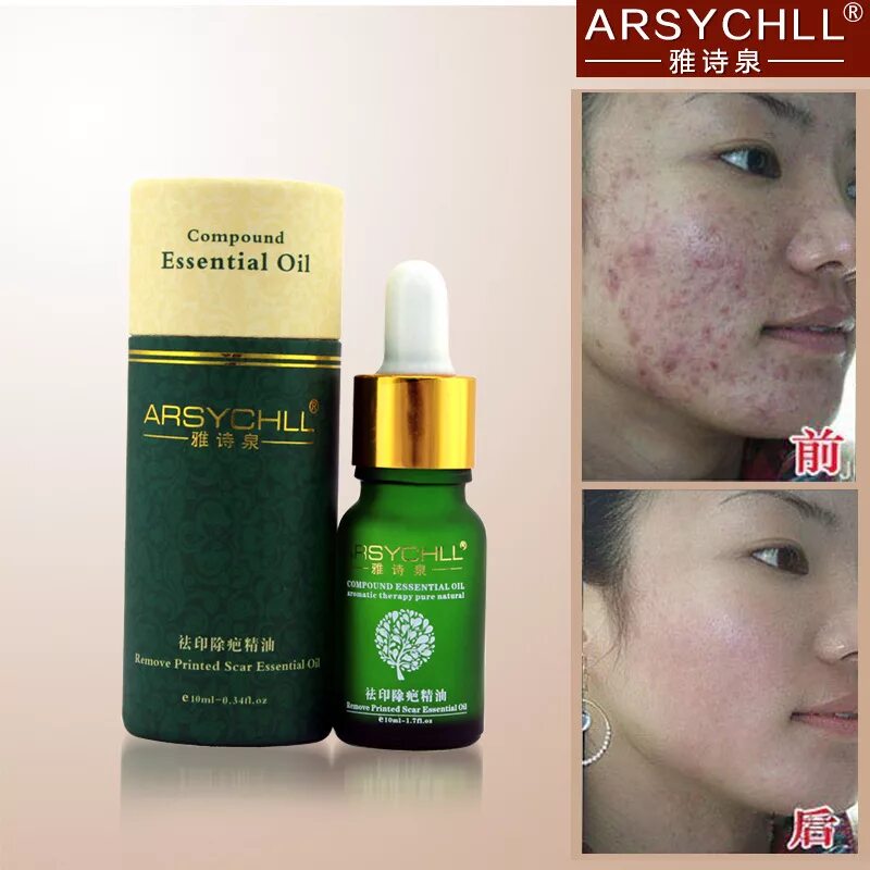 сыворотка для лица face serum anti-acne serum. биоматрикс косметика сыворотка с азелаиновой кислотой. сыворотка для лица от прыщей. сыворотка от акне и постакне. крем против постакне.