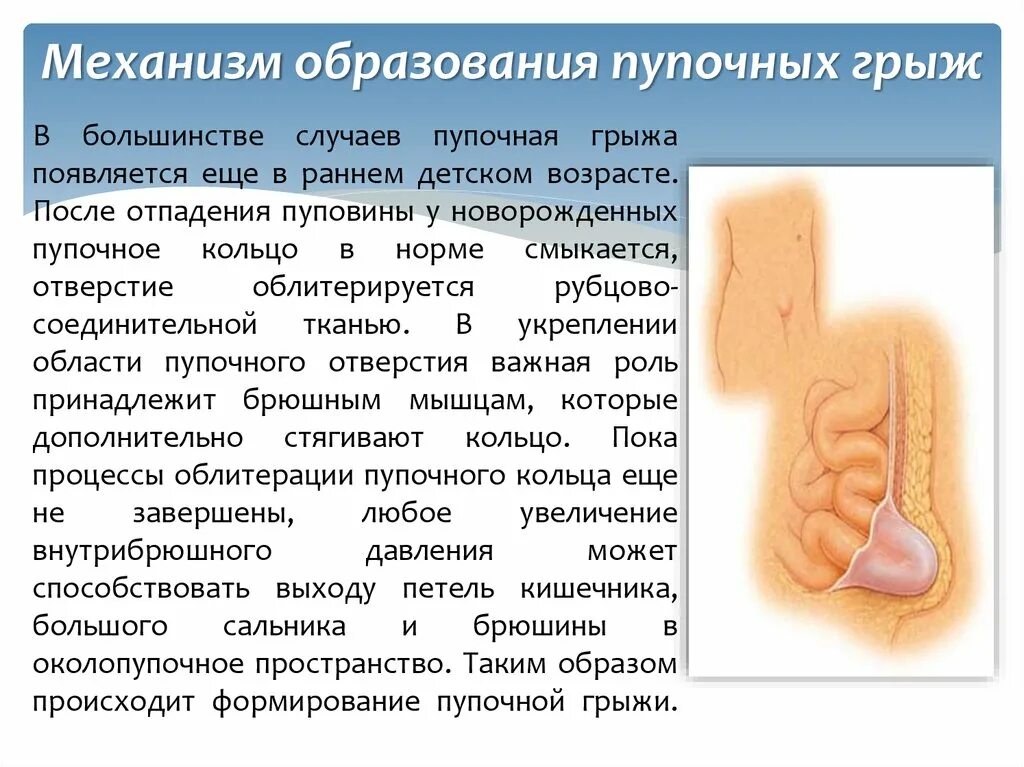 Локальный статус грыжи. Механизм образования пупочной грыжи. Причины образования пупочной грыжи. Выпячивание пупочной грыжи.