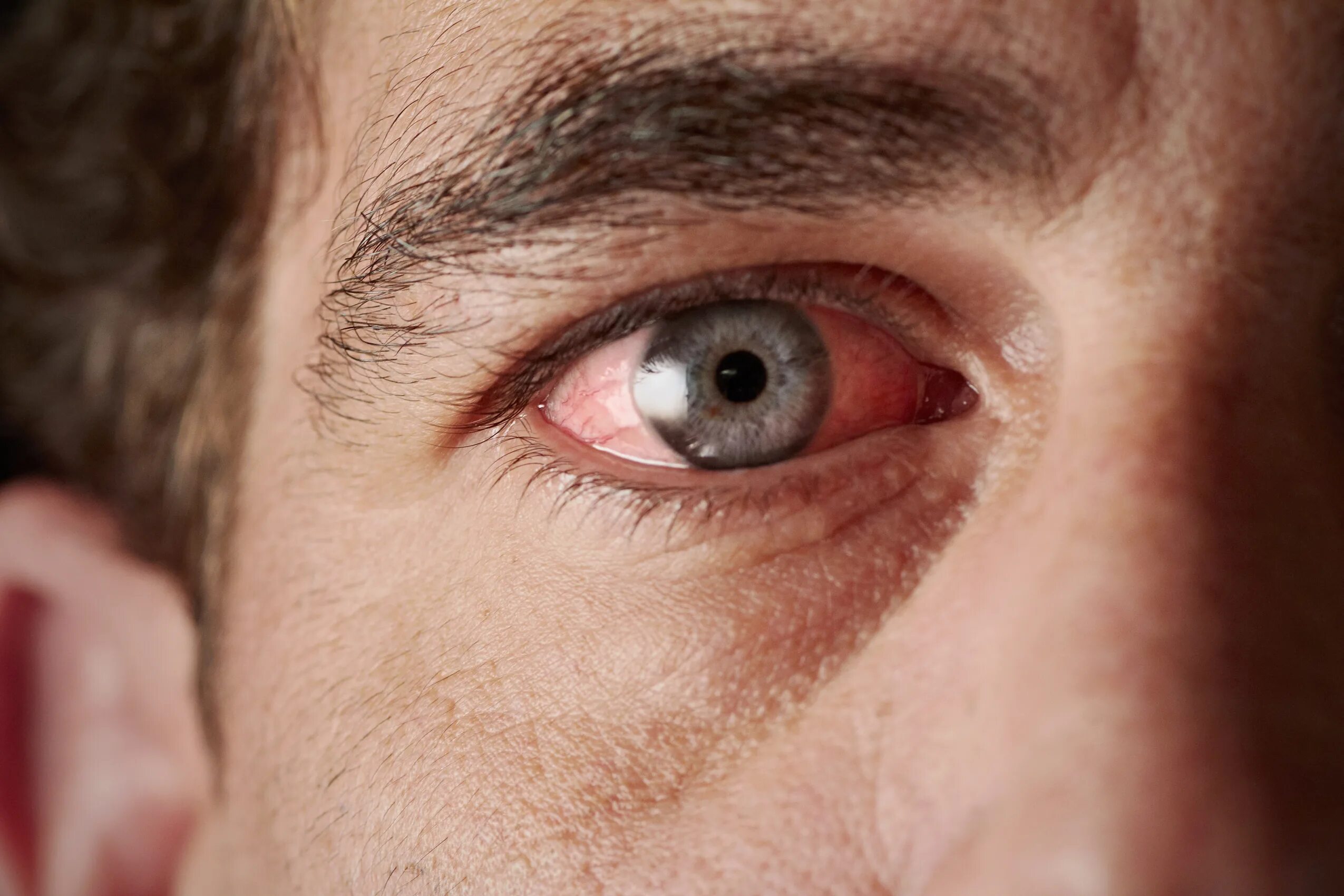 He eyes are red