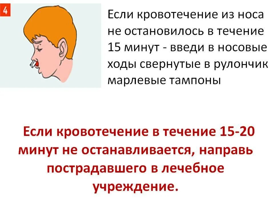 Как долго идет кровотечение. Остановить кровотечение из носа. при кровотечении из носа. как остановить носовое кровотечение. остановка носового кровотечения у детей.