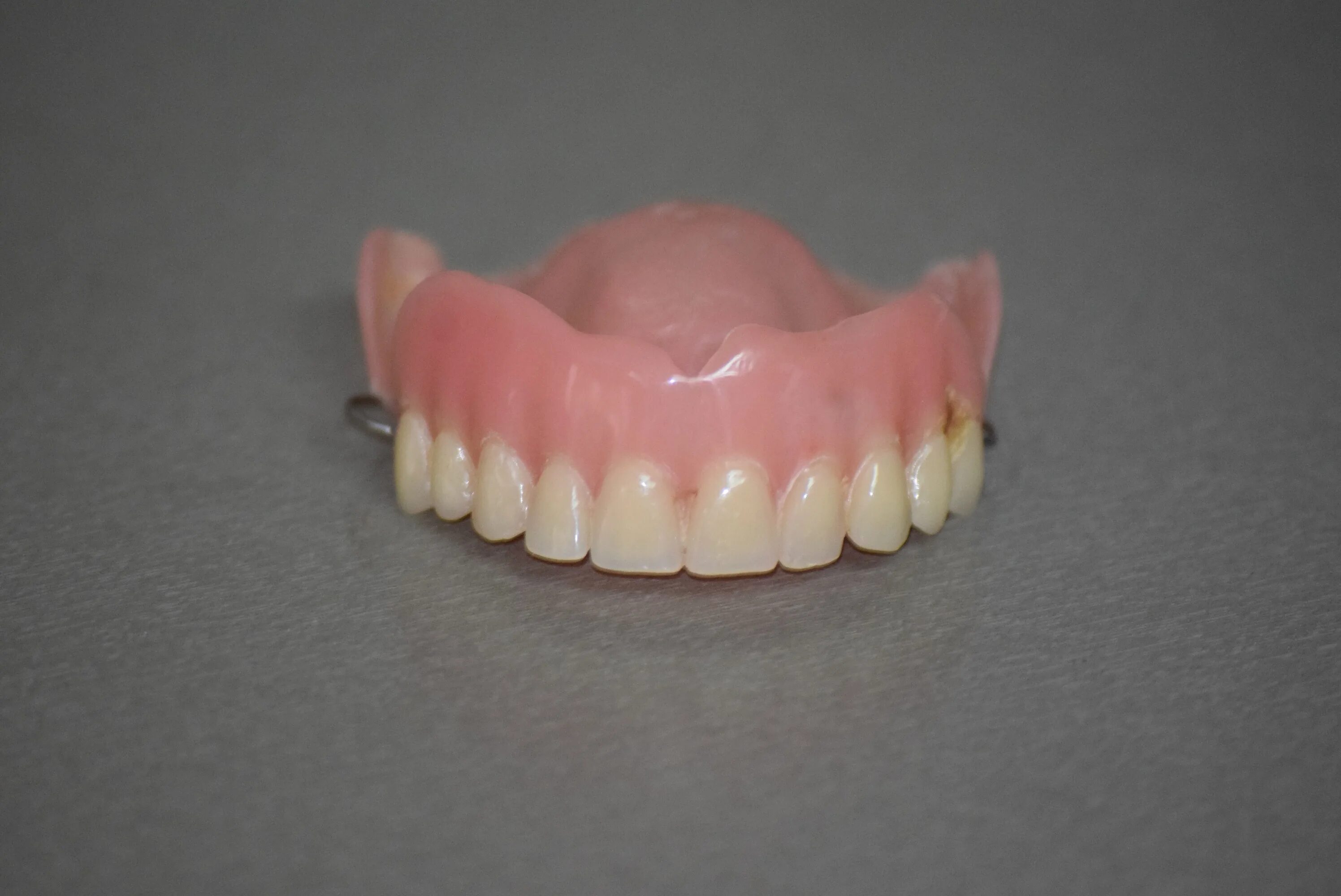 Протез на челюсть без зубов. Съемный протез (6-14 зубов) термо Джет. Пластинчатый микропротез. Частичный съемный протез Flexi n512.