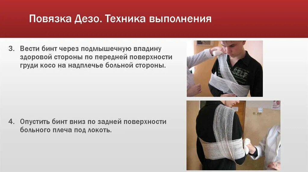 Алгоритм повязки. Технику наложения повязки дезо.. дезо повязка бинтовая техника. дезо повязка бинтом алгоритм. наложение повязки дезо алгоритм.