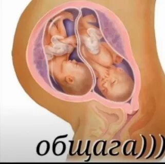 Двойня патологии