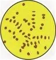 Тельца пашена микроскопия. Тельца пашена и тельца гварниери при натуральной оспе. Пашен тельца. Пашен тельца. Тельца пашена и тельца гварниери при натуральной оспе.