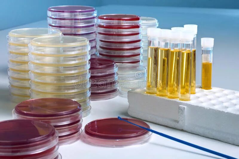 Бак посевы на чашках петри. Питательные среды в лаборатории. Методы стерилизации посуды и питательных сред. Разлив питательных сред в чашки петри. Пробирка колба чашка петри.