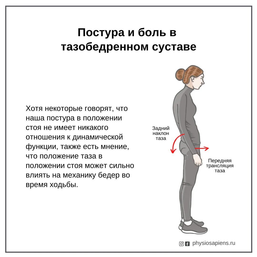 Боль в бедренном суставе. Боль в тазобедренном суставе. Тазобедренный сустав болит при ходьбе. Локализация боли в тазобедренном суставе. Причина боли в правом тазобедренном суставе