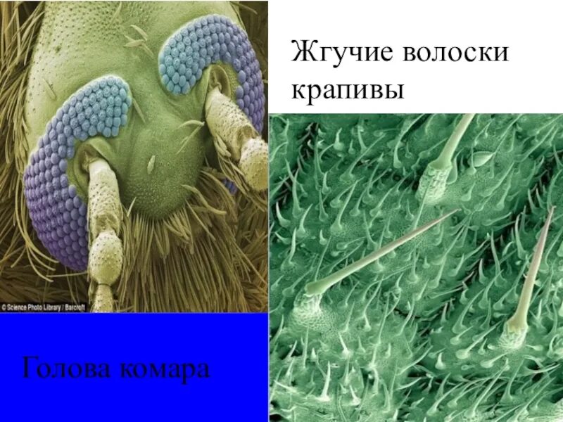 Строение волоска крапивы. Волоски крапивы под микроскопом. Жгучие волоски. Клетки крапивы. Волоски на листьях.