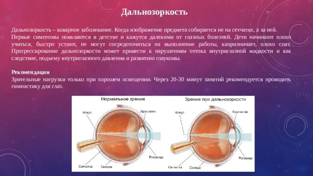 Дальнозоркость что делать. Дальнозоркость сетчатка. Стекла при дальнозоркости. Очки для коррекции дальнозоркости. Очки для дальнозоркости плюс.