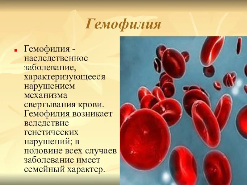 Гемофилия группа крови. Гемофилия 8 класс биология. Наследственные болезни. Наследственные заболевания по биологии.