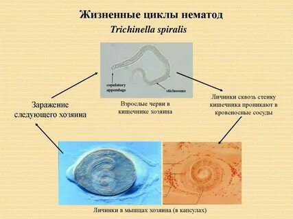Жизненный цикл трихинеллы