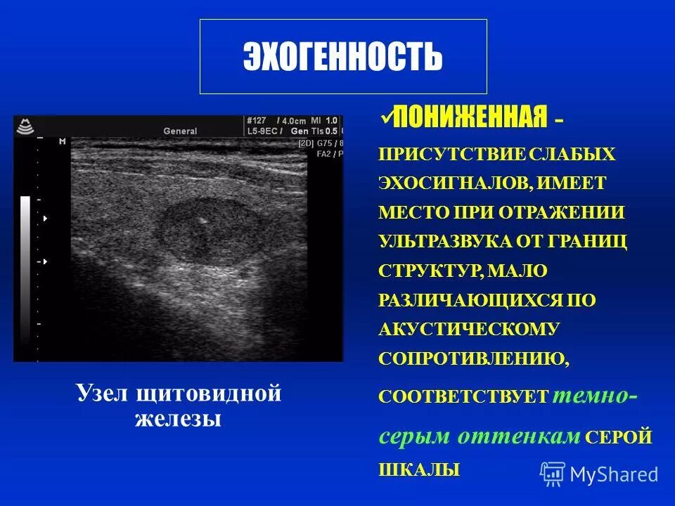 Поджелудочная диффузно повышенной эхогенности