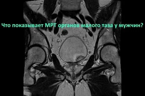 Кт органов таза у мужчин. Мрт малый таз с контрастом. Кт малого таза у мужчин. Мрт органов малого таза у мужчин. Мрт органов малого таза с контрастированием.