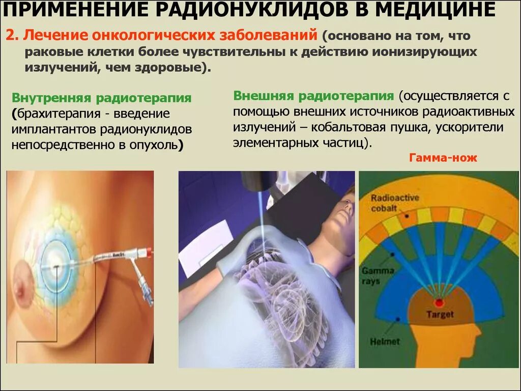 Применение радиоактивности в медицине. Радиация в медицине. Радиоактивное излучение в медицине. Радиация в медицине презентация. Применение радиации в медицине.