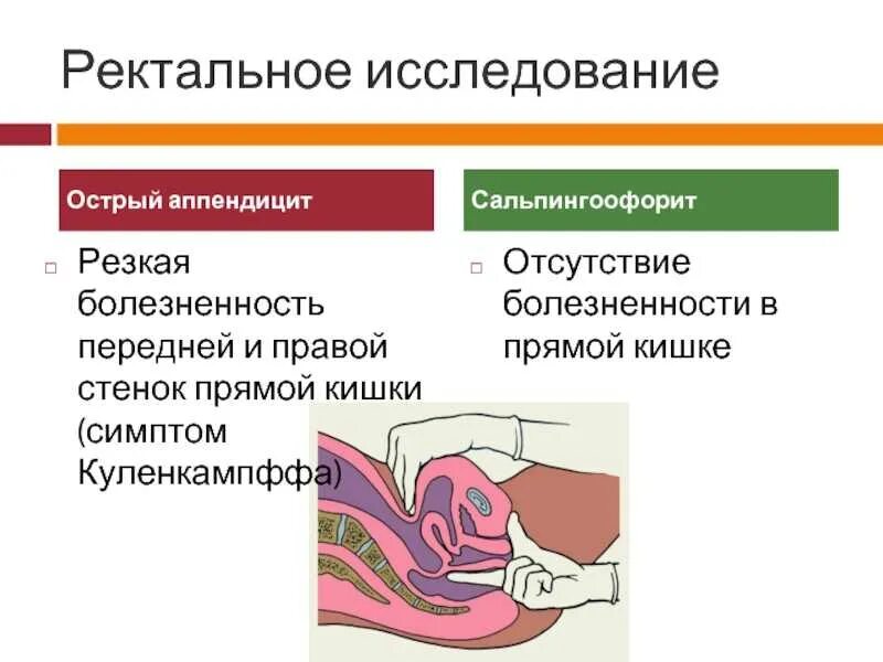 Тест ректально. Сальпингоофорит (аднексит). Острый сальпингоофорит клиника. Острый сальпингоофорит симптомы. Хронический сальпингоофорит клинические рекомендации.