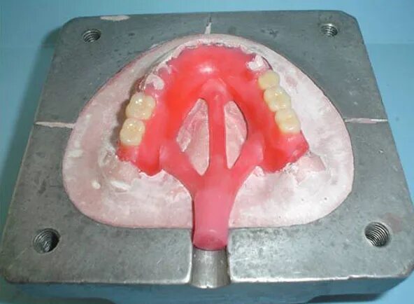 Гипсовка протеза в кювету. Литниковая система бюгельного протеза. Загипсовка моделей в кювету. Литьевые пластмассы в стоматологии.