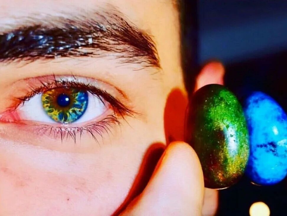 Гетерохромия радужной оболочки. Радужка разного цвета. Центральная гетерохромия серых глаз. Центральная гетерохромия зеленый карий. Центральная гетерохромия зеленый карий.