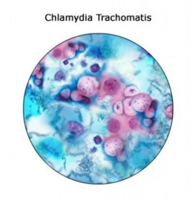 Бактерия хламидия трахоматис. Трихомонатис хламидия трахоматис.