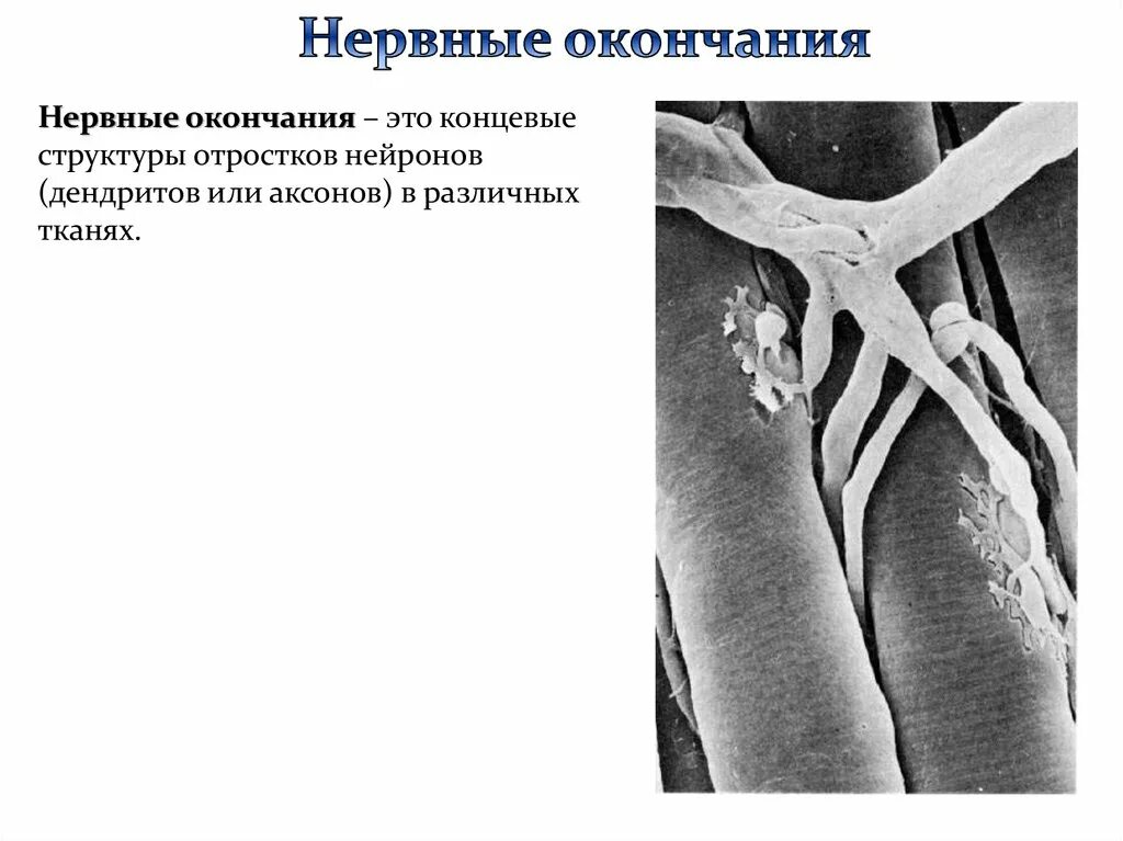 Функции нервных окончаний. Нервные волокна. Окончание нервных волокон. Нервные волокна заканчиваются. Окончание нервных волокон.