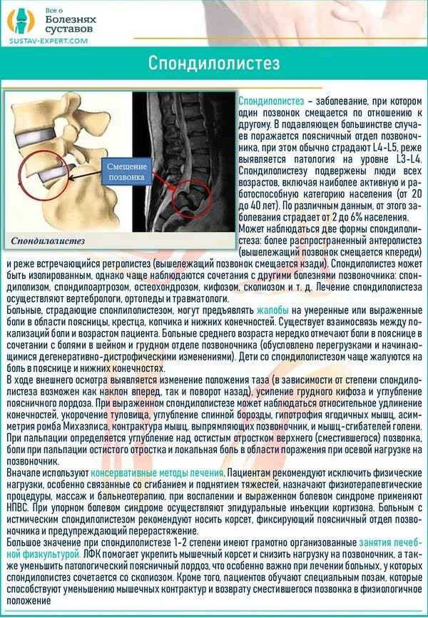 Симптомы поясничного крестцового отдела позвоночника. Смещение 5 позвонка поясничного отдела симптомы. Сместился позвонок в пояснице. Смущение позвоночника. Смещение диска в поясничном отделе.