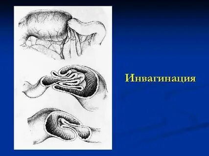 Классификация кишок