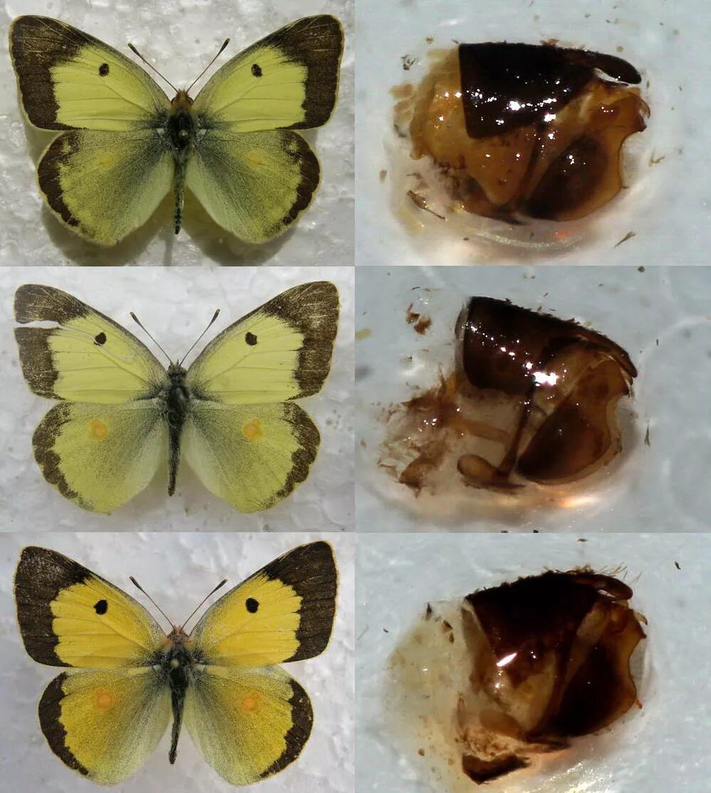 биохимический анализ крови при механической желтухе.