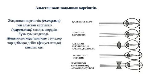 Жалаңаш жезөкшелердің порнографиялық суреттері