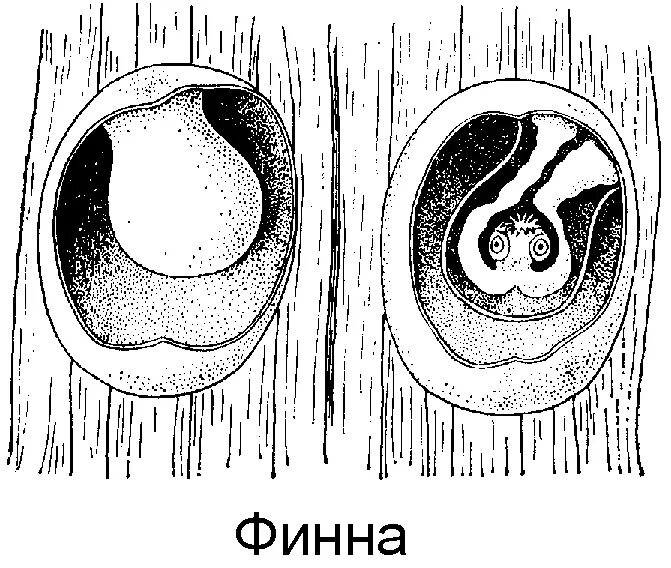 Финна цистицерк строение. Финна свиного цепня строение. Яйцо с онкосферой