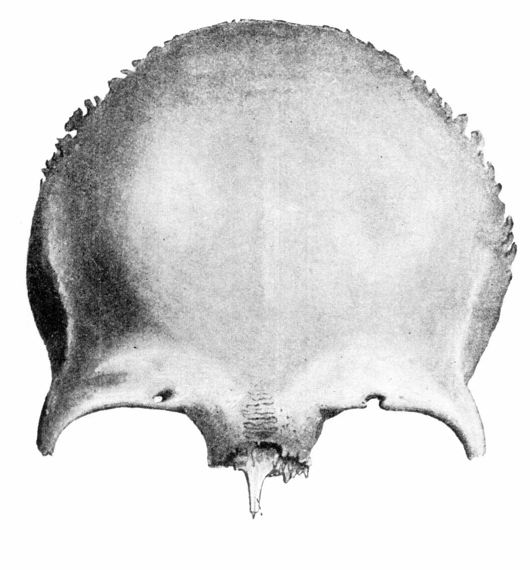 Кости черепа лобная кость анатомия. Лобная кость os frontale. Лобная кость вид спереди и снизу. Лобная кость снизу анатомия.