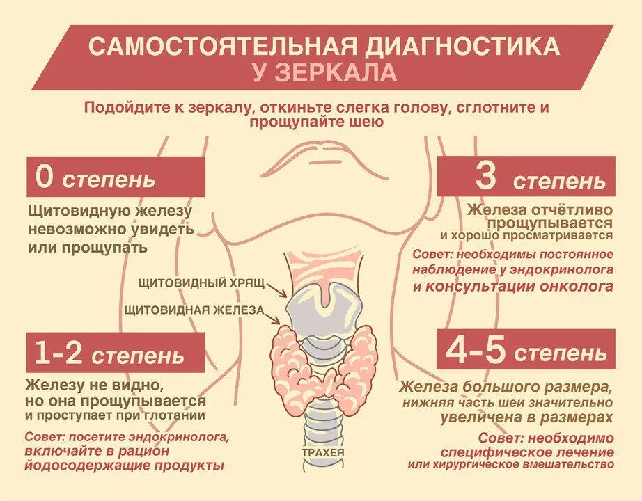 Исцеление щитовидной железы. Узелок на щитовидной железе. Щитовидная железа у женщин. Узлы в щитовидной железе симптомы у женщин.