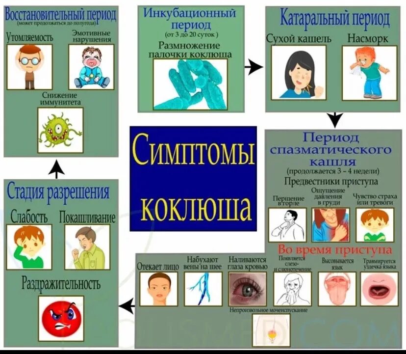 Симптомы кошлюш а у детей. Признакю коклюша. Коклюш клинические проявления.