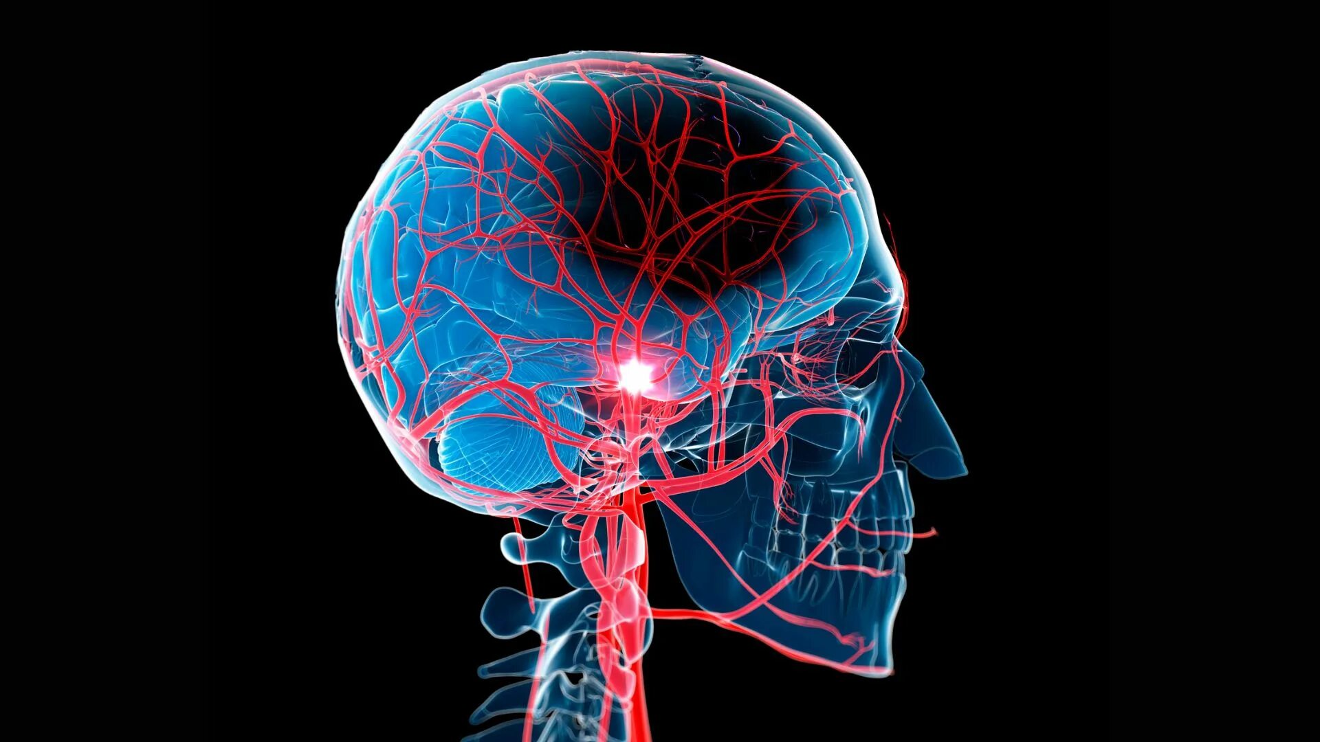 Поражение мозга лечение. Кровеносные сосуды мозга.