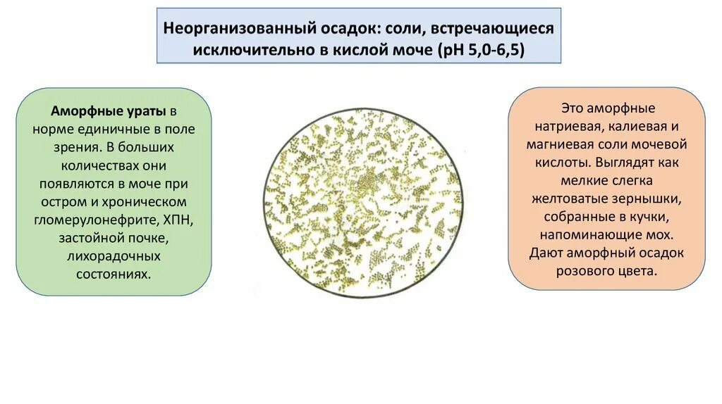 Ураты в моче. Соли в моче. Ураты в моче микроскопия. Ураты и соли мочевой кислоты. Высокая соль в моче