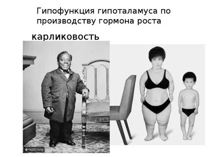 Недостаток гормонов гипоталамуса