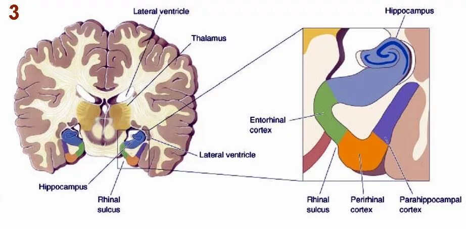 Повреждение гиппокампа. Структура гиппокампа. Гиппокамп на препарате. Строение гиппокампа. Локализация гиппокампа.