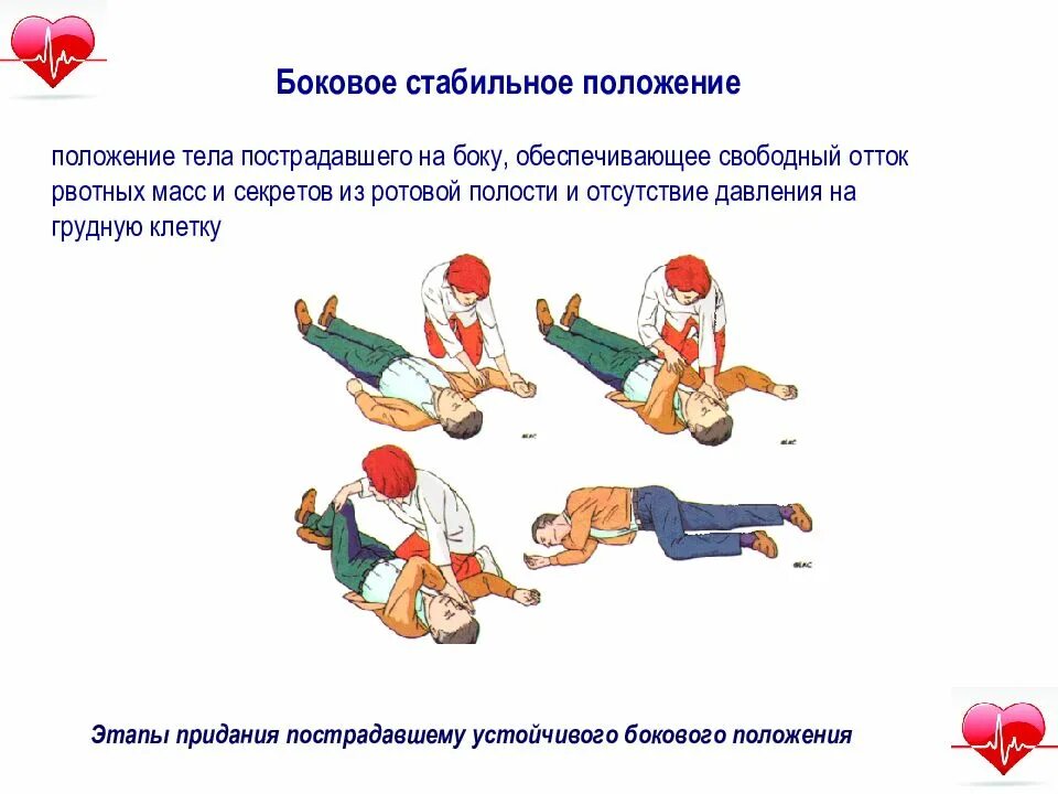 Как придать устойчивое боковое положение пострадавшему. Сердечно легочная реанимация устойчивое боковое положение. этапы придания пострадавшему устойчивого бокового положения. алгоритм придания устойчивого бокового положения. перевести пострадавшего в устойчивое боковое положение.