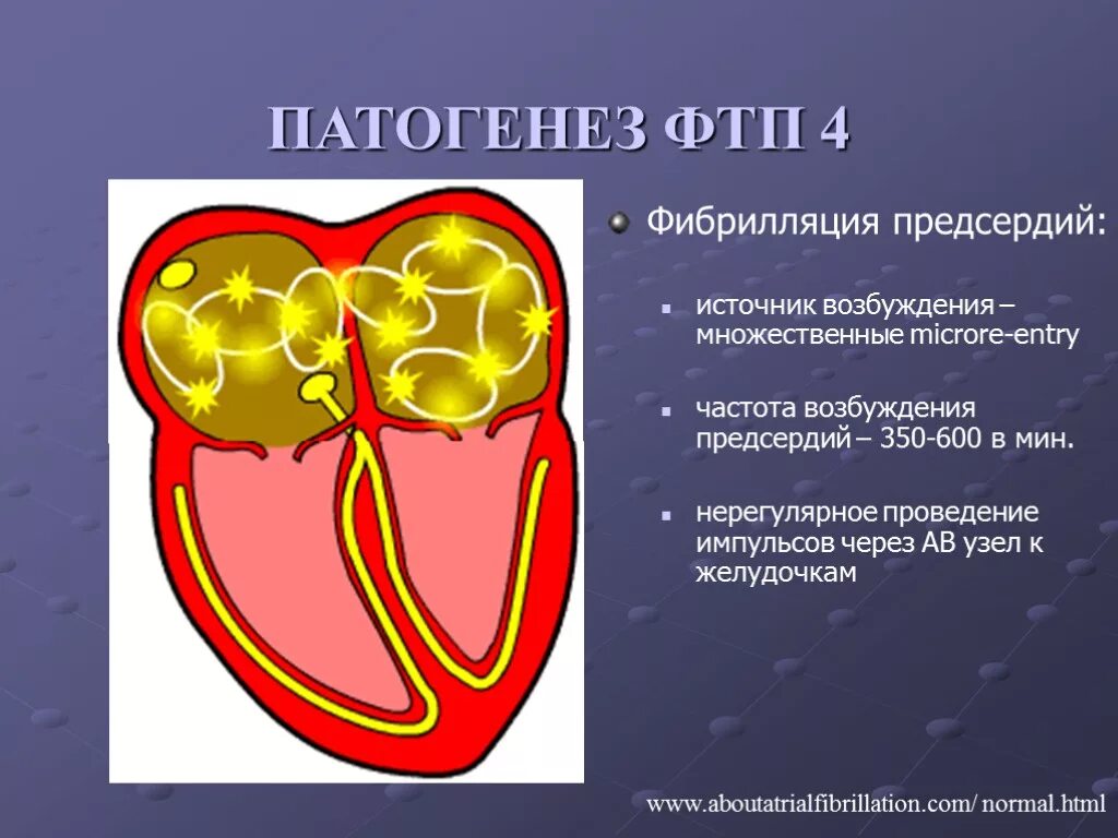 Предсердие болезни. Патогенез фибрилляции предсердий. Фибрилляция предсердий этиология. Трепетание предсердий этиология. Фибрилляция и трепетание предсердий этиология.