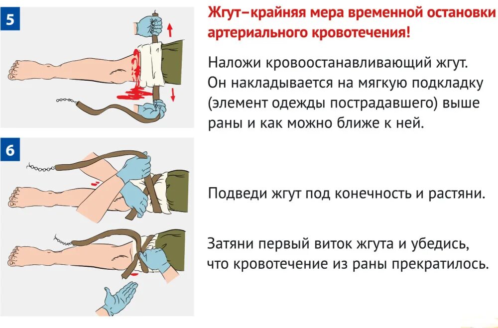 1 помощь при артериальном кровотечении конечностей. Пострадавшему с артериальным кровотечением. причины артериального кровотечения. жгут крайняя мера временной остановки артериального кровотечения. при артериальном кровотечении нижней конечности.