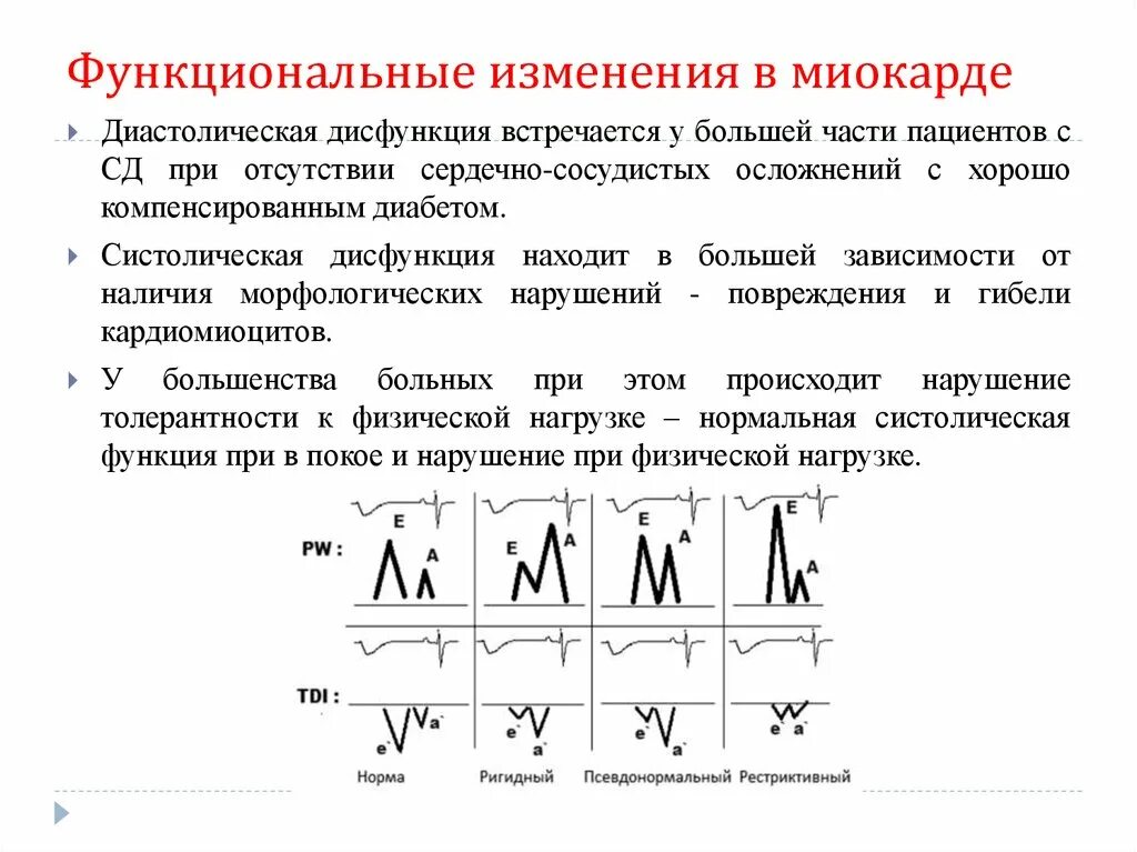 Дисфункции желудочков сердца. Диастолическая дисфункция миокарда левого желудочка. Типы нарушения диастолической функции лж. Диастолическая дисфункция правого желудочка по 1 типу. Диастолическая дисфункция левого желудочка 2 типа что это такое.