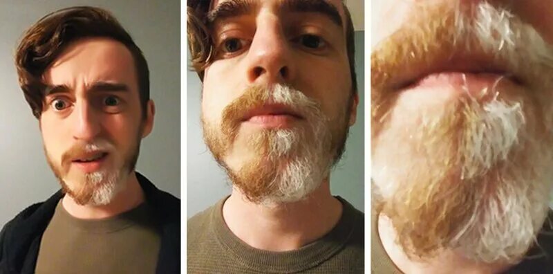 Почему появляется борода. Обесцвечивание бороды. Белая борода. Плохо растет борода. Плохая борода.