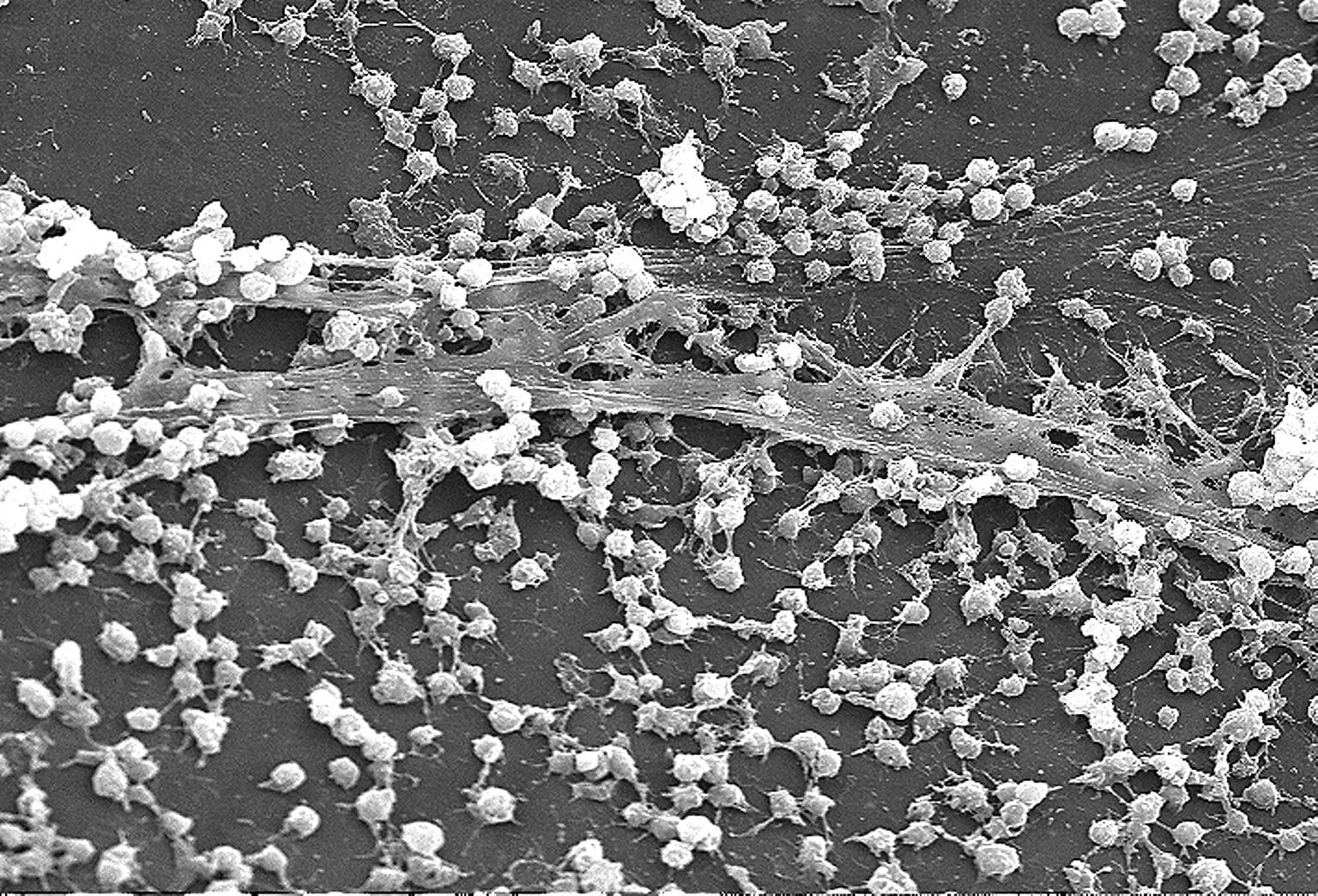 Staphylococcus epidermidis биопленки. Биопленки Staphylococcus aureus. Биопленка кандида. Биопленка золотистого стафилококка.