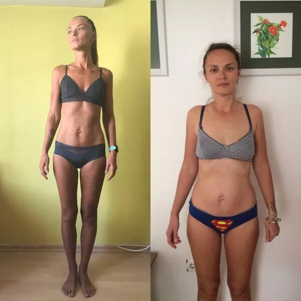 похудение до и после фото. минус 5 килограмм до и после. диета до и после. 5 кг до и после. -10 кг до и после.