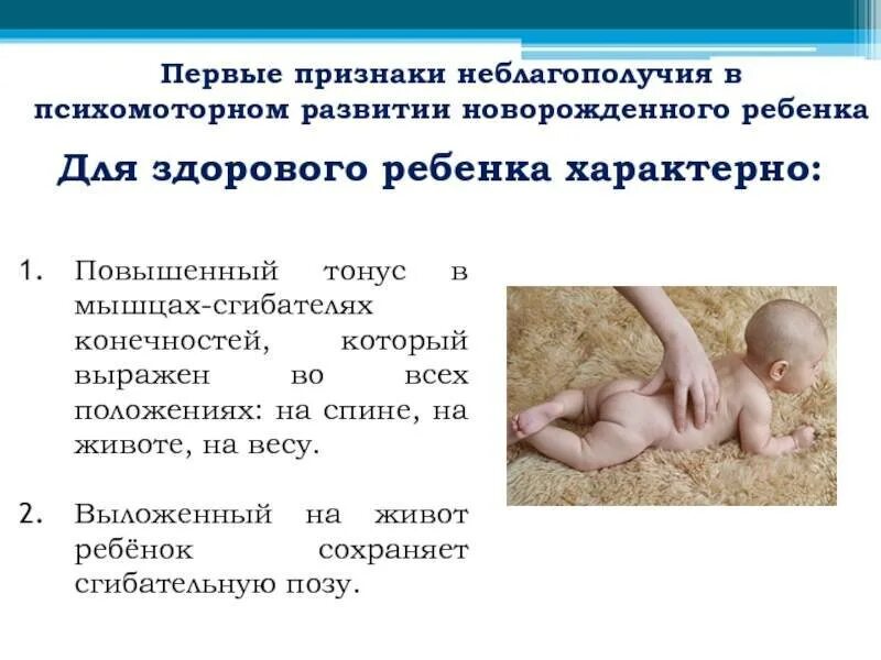 Признаки новорожденности. Тонус мышц у новорожденных. Мышечный тонус у новорожденного. Развитие новорожденного ребенка. Тонус мышц у новорожденных симптомы.