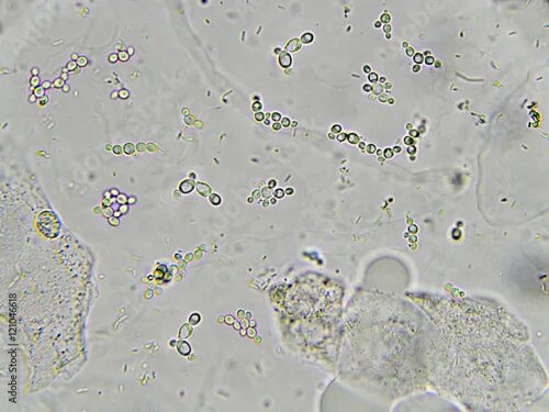 Дрожжевые клетки в моче повышены. Грибы кандида микроскопия. Кандида альбиканс в микроскопе. Дрожжевые грибы микроскопия мочи. Дрожжевые грибы в моче микроскопия.