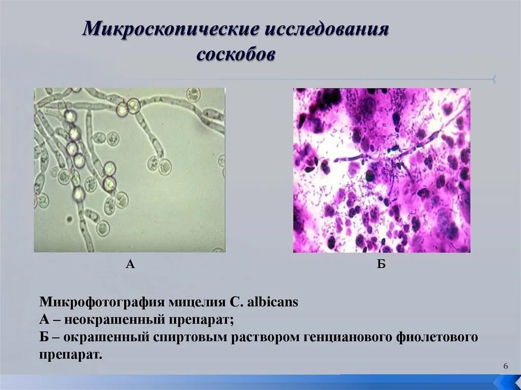 На коже обнаружены споры