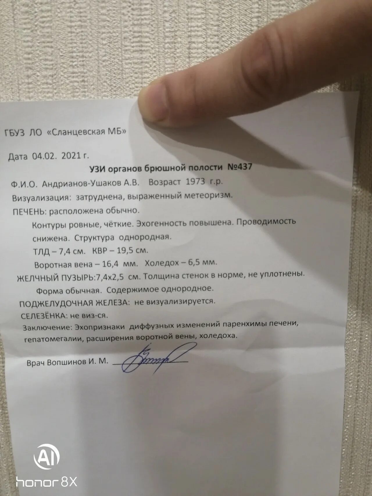 УЗИ бр полости. Нормальное УЗИ органов бр полости. УЗИ орг бр полости. УЗИ орг бр полости фото. Сделал узи без направления