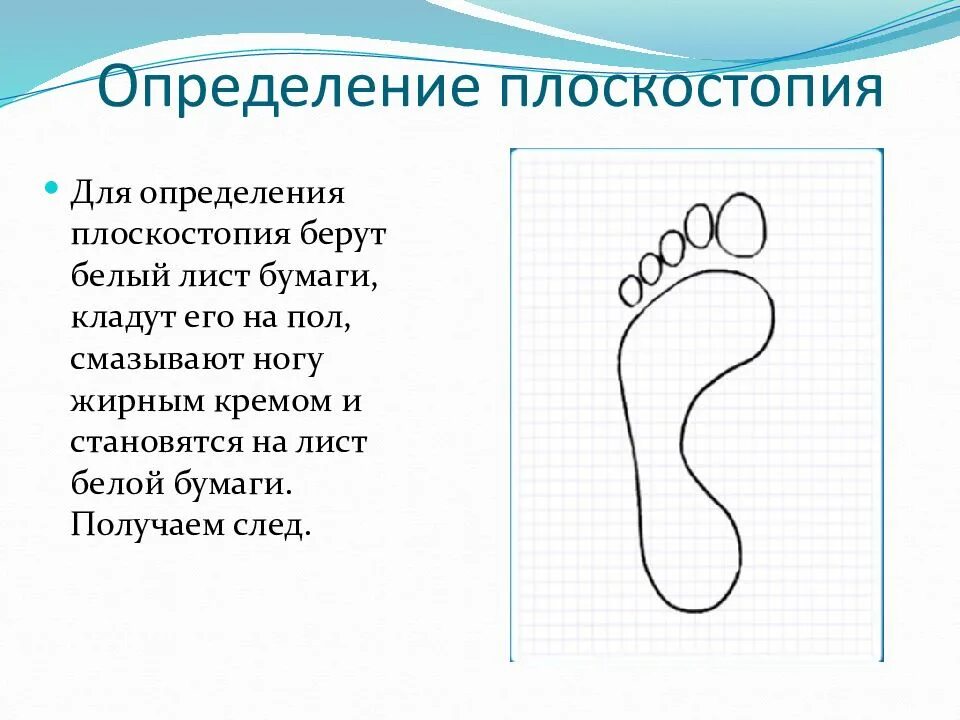 Плоскостопие на одной ноге берут ли. Выявление плоскостопия. Плоскостопие отпечаток. Отпечаток ноги с плоскостопием. Определение плоскостопия.