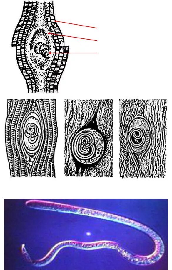 Инкапсулированная личинка трихинеллы строение. Trichinella spiralis инкапсулированная личинка.